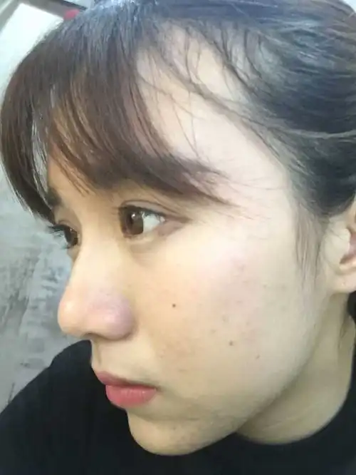 五官再好看,脸上有这个也没用