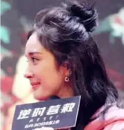 头发油腻脸上长痘笑起来嘴非常瘪杨幂怎么越来越丑了