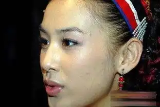 杨幂自曝脸上巨痘世界崩溃图揭女星惨不忍睹的痘痘肌