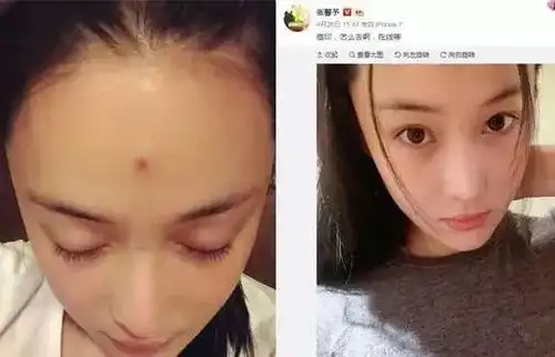 明星长痘也疯狂刘涛显少女,蒋欣调皮可爱,张馨予美出新高度