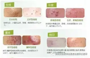 痘痘反反复复长,你还在以为只是痘痘吗
