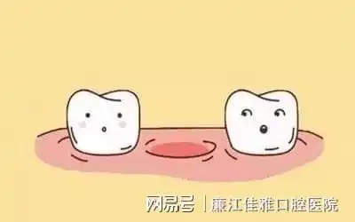 廉江牙医缺了一颗牙不用管是我太天真了.......
