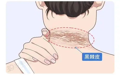 胖人和瘦人谁更容易患癌中国新研究出炉这些地方的人更危险