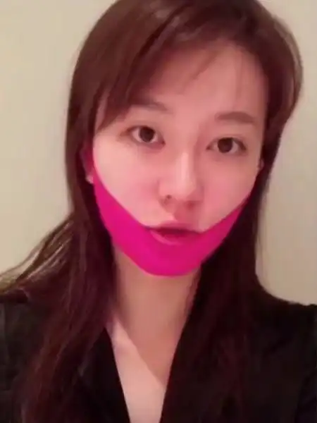 女明星长痘也喜欢晒,乔欣说自己是乞丐肌,刘涛痘痘遮都遮不住