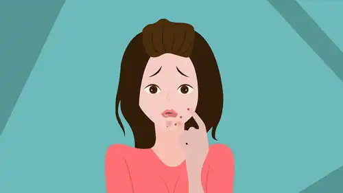 长痘痘了怎么办是不是经常长痘痘