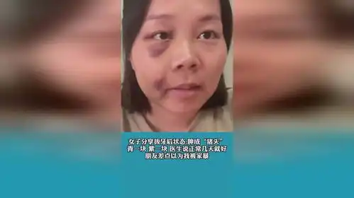 女子分享拔牙后状态肿成猪头青一块紫一块,朋友差点以为我被家暴