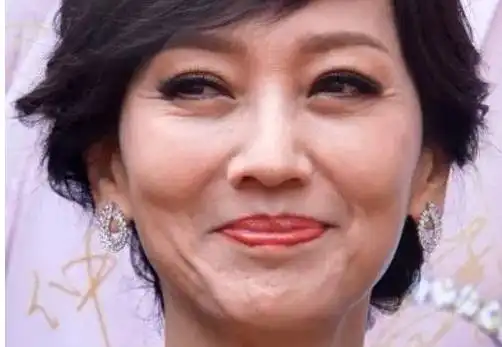 明星都是假冻龄赵雅芝满脸皱纹,实在辣眼睛