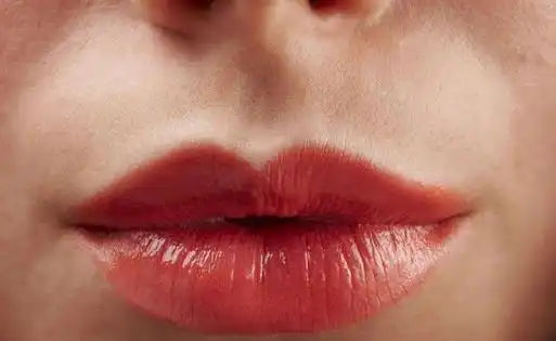 皱纹嘴是不是长嘴角皱纹的呢,怎么去除皱纹嘴妙招