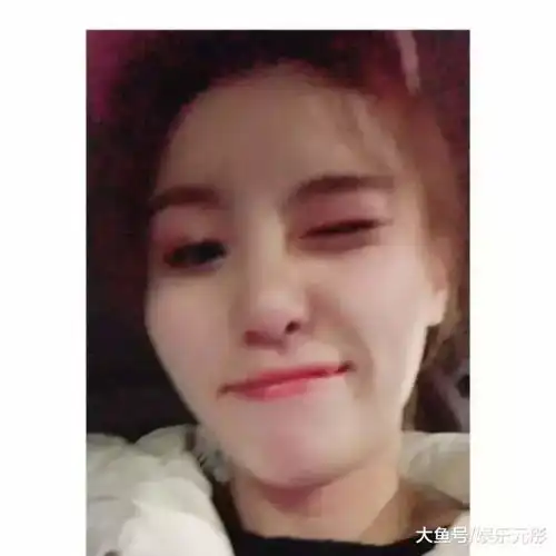 傅园慧整牙后神似刘诗诗,网友我相信baby只整过牙了
