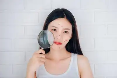日光性皮炎皮肤长丘疹很痒怎么办