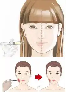薇拉薇拉的分类