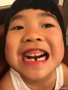森碟近照曝光,女大十八变爸爸去哪儿曾经的小萝莉都长成什么样了组图