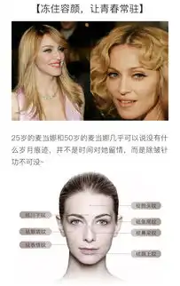 衡力除皱针悦美自营旗舰店高品质除皱针去鱼尾纹抚平皱纹表情自然肌肉不酸沉悦美整形