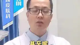 脓包型痤疮能喝ad钙奶吗,脓包型痤疮用什么洗澡