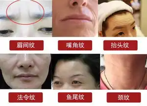 满脸皱纹没救了用它一抹全消失,再没人喊你大妈