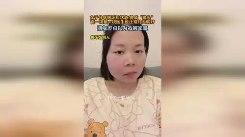 女子分享拔牙后状态肿成猪头,朋友差点以为我被家暴