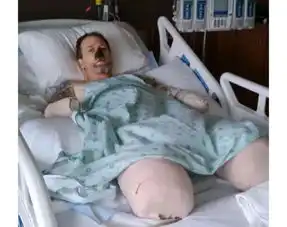 死亡之吻被爱犬舔了下,去世不是因为狂犬病