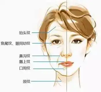 都是除皱,玻尿酸和肉毒素有什么区别