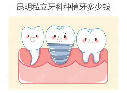 在昆明私立牙科做的种植牙挺便宜,种植牙一颗价格1850元全包