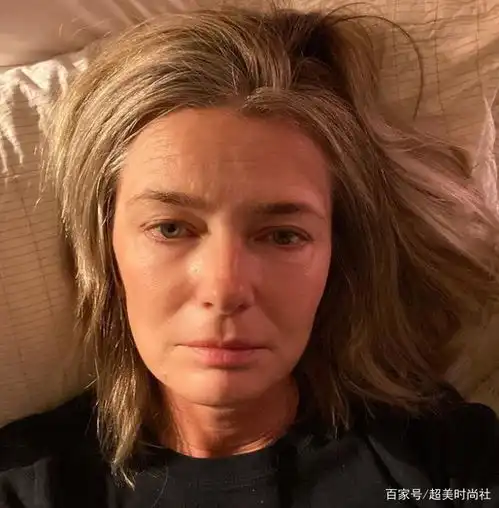 捷克名模晒皱纹素颜衰老照,表情呆滞被疑抑郁症,被渣男坑一生