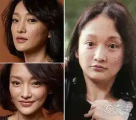 baby杨幂李易峰杨洋真容满脸痘痘颜值被拉低