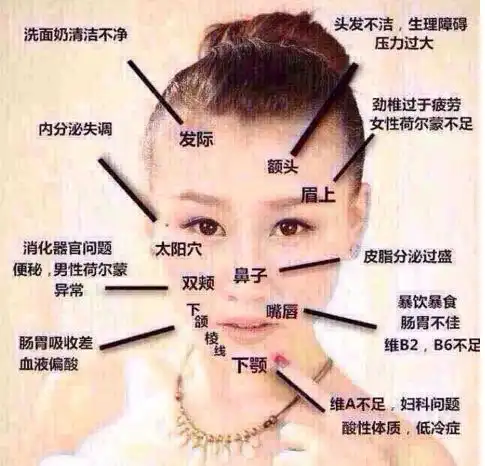 一张图了解长痘痘部位的原因