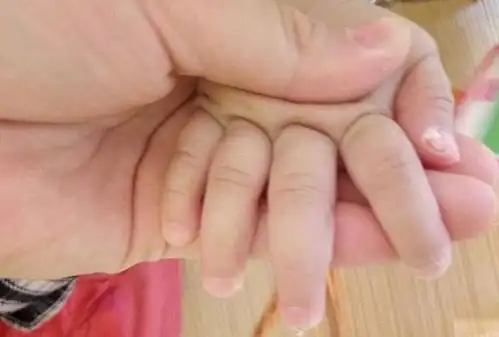 春捂怎么捂才正确两暖一凉原则,宝宝才能少生病