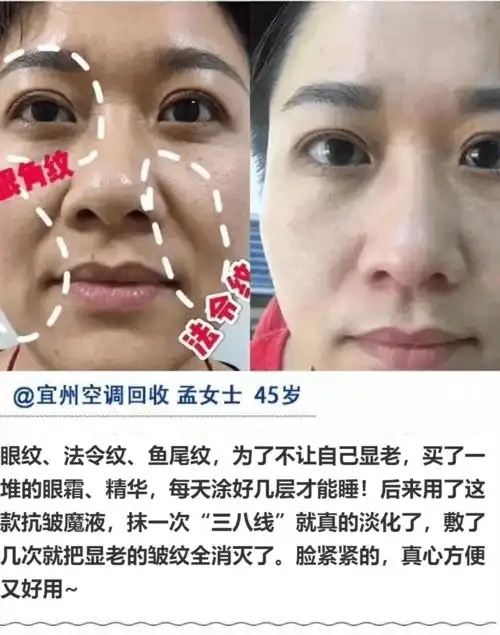 满脸皱纹没救了用它一抹全消失,再没人喊你大妈