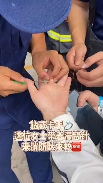 戒指卡手,带着滞留针来消防队求救,这下真的长记性了