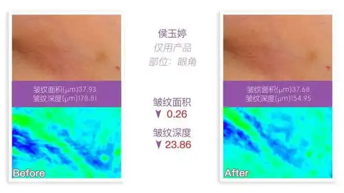 小茂最强肌诊室三重抗皱,十级淡纹的眼霜,来了