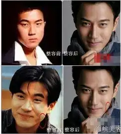 细数娱圈假面小生男星整容比女星更疯狂