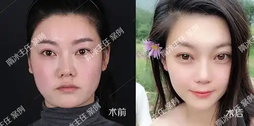 文章详情