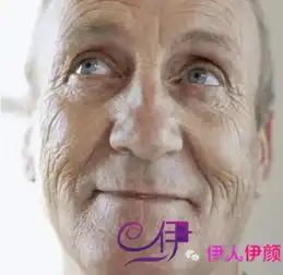 只有老了才会有皱纹吗关于皱纹的这3件事必须清楚