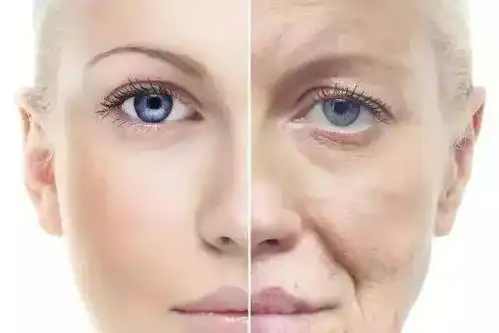 如何轻松解决脸部皱纹丨科普篇