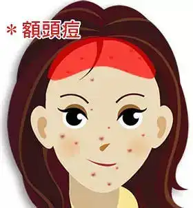 下巴反复长痘,你知道根本原因吗