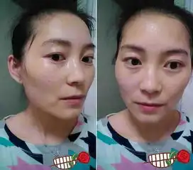 美白祛斑就靠一碗粥,雀斑也能淡,两个月无暇肌肤