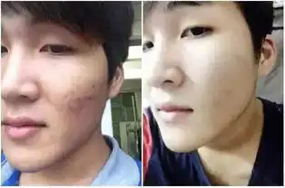 祛痘成功后,痘花妹遭宝马男猛追浙大校花门事件当事人陈述