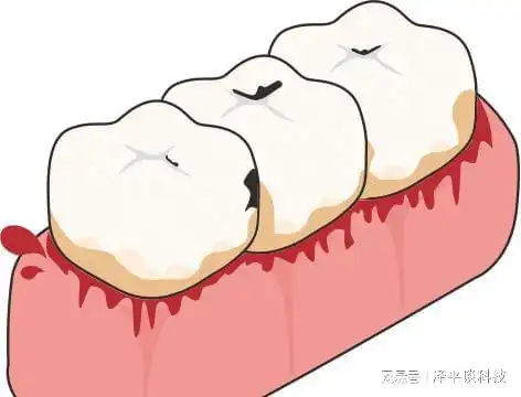 那些年我们深信不疑的口腔健康传言,今天带你了解真相