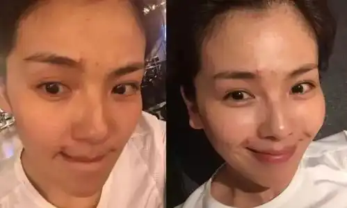 我发现99的人,还搞不清自己的肤质