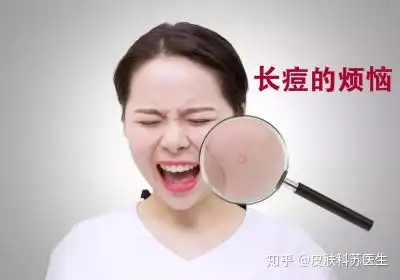 郑州有看痘痘比较好的为什么冬天一吃火锅脸上就长痘