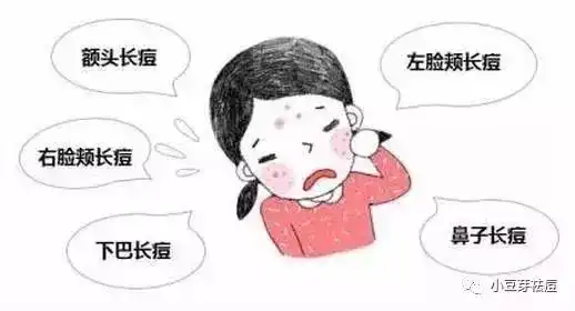 小豆芽老师,青春期长痘是每个人都会经历的吗脸上爱长痘是为啥