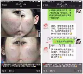 知乎显微镜下的痘痘,一个痘痘200条虫长痘必看.......