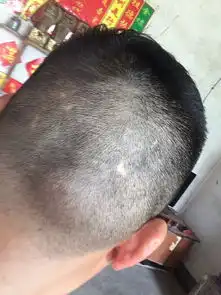 高锰酸钾可以涂在头上吗