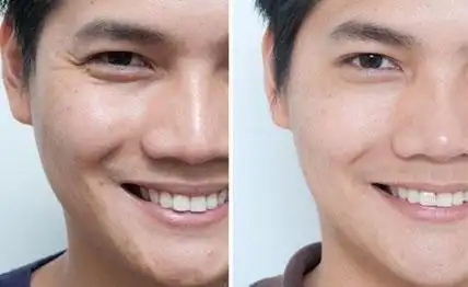 如果你想做整形,这些整形常识你可以看看