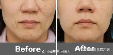 笑起来嘴角那两个像小括号的叫什么