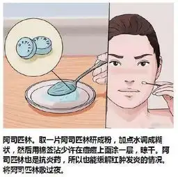 脸上各部位长痘痘图解快速祛痘的简单方法
