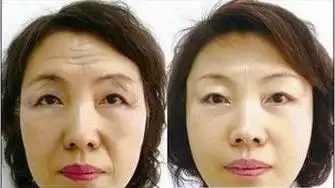 用了这个洗脸方法,50岁也不会出现皱纹,教你正确